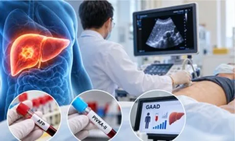 Năm nào cũng siêu âm vẫn không phát hiện ung thư gan, bác sĩ chỉ lý do