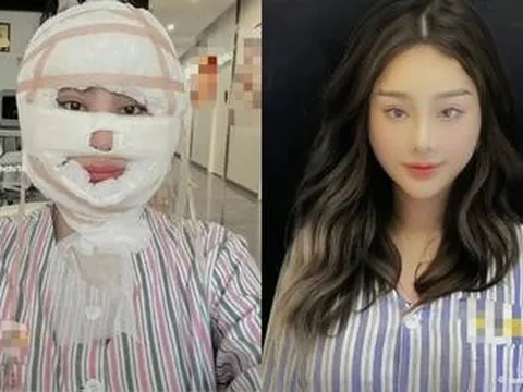 Lâm Khánh Chi ngầm xác nhận việc 'dao kéo', netizen xót xa thay cho nữ ca sĩ