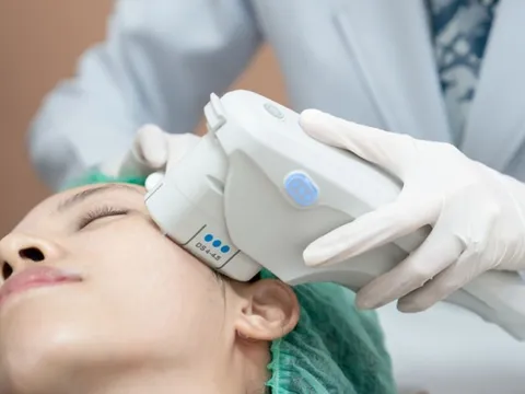 Ultherapy PRIME – Chuẩn mực mới của công nghệ nâng cơ không xâm lấn tại Việt Nam