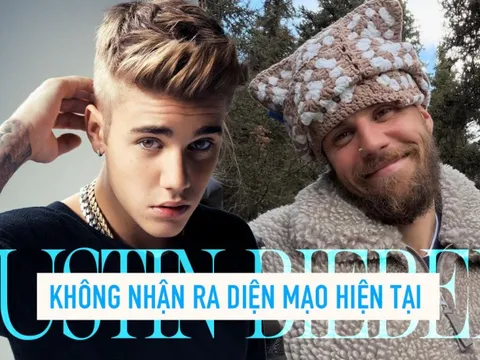 Không nhận ra diện mạo hiện tại của Justin Bieber