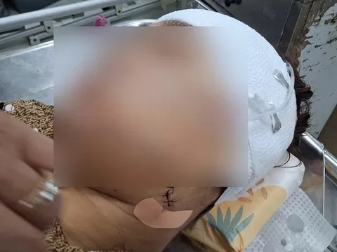 Điều tra vụ nữ công chức rạch mặt bạn gái của chồng gây thương tích nặng