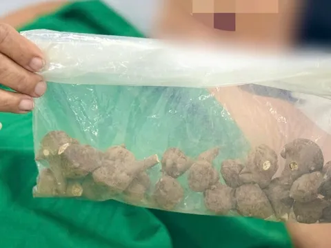 Sắc 5 củ ấu tẩu uống chữa đau khớp, cụ bà sốc tim suýt tử vong 0