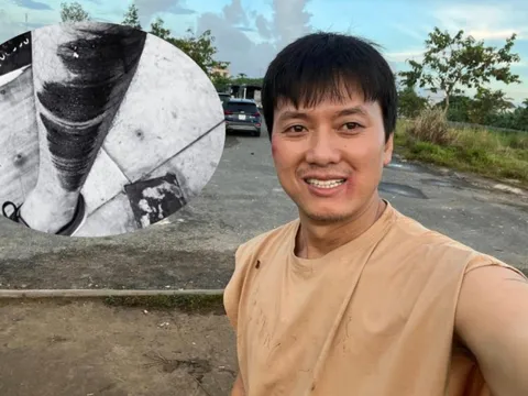 Nam diễn viên Vbiz gặp sự cố giao thông trên đường đi quay, nhiều đồng nghiệp lo lắng gửi lời hỏi thăm