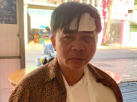 Nam diễn viên 57 tuổi gặp tai nạn bị gãy xương vai, ngã đập đầu xuống đất