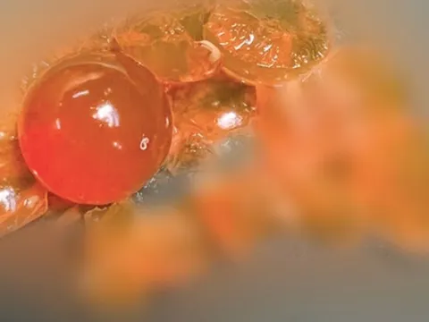 Bé trai 14 tháng tuổi phải nhập viện vì nuốt hạt nở đồ chơi 0