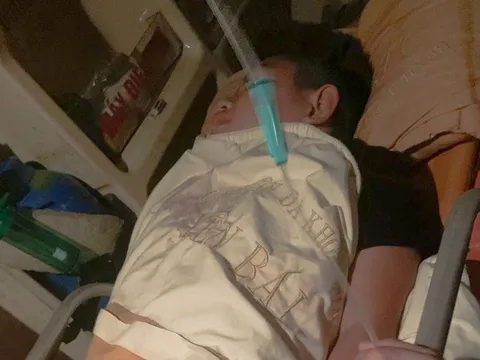 Tình trạng sức khỏe nam sinh bị bạn hành hung rồi hất xuống hồ ở Lào Cai 0