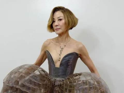 Nữ diễn viên lộ vóc dáng hốc hác vì giảm cân quá đà, người hâm mộ hoang mang