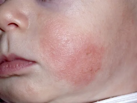 Cấp đủ ẩm cho da bé - bí quyết phòng ngừa các vấn đề về da mùa thu đông 0