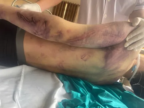 Bộ Y tế yêu cầu rà soát các cơ sở trợ giúp xã hội sau vụ học viên tử vong ở Quảng Ninh 0