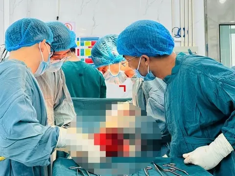 Chủ quan không điều trị, người phụ nữ mang khối u tử cung “khổng lồ” nhiều năm