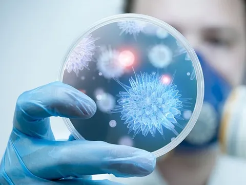 Bộ Y tế khuyến cáo người dân hạn chế đến khu vực có dịch bệnh do virus Nipah