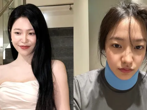 Tình trạng của Yeri (Red Velvet) sau khi bị gãy cổ