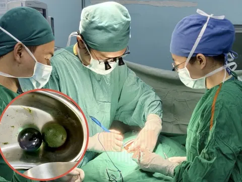 Bé gái 18 tháng tuổi nguy kịch, ruột tắc nghẽn vì nuốt hạt nở đồ chơi 0