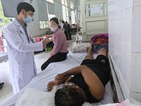 Cảnh báo tai nạn do pháo nổ dịp cận Tết 0