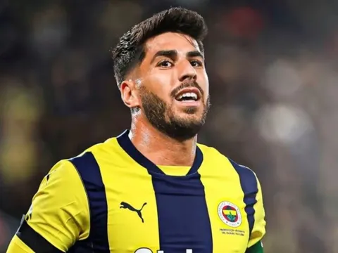 Khác biệt của Asensio