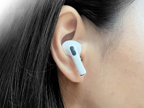 Đeo tai nghe 1-3 giờ mỗi ngày, người trẻ đối mặt nguy cơ điếc sớm 0