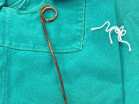 Quên thiết bị y tế trong bụng suốt hai năm