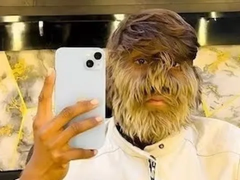 Chàng trai 'người sói' và hành trình nổi bật giữa hàng triệu người