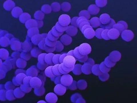 Sốt cao kèm rét run nhiều ngày, cô gái phát hiện mắc bệnh nguy hiểm