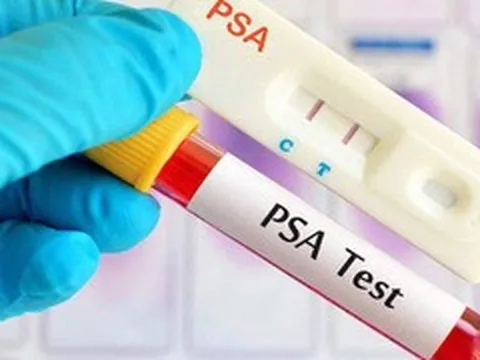 1 ngày 3 ca ung thư tuyến tiền liệt: Sai lầm khiến quý ông lỡ 'thời điểm vàng'
