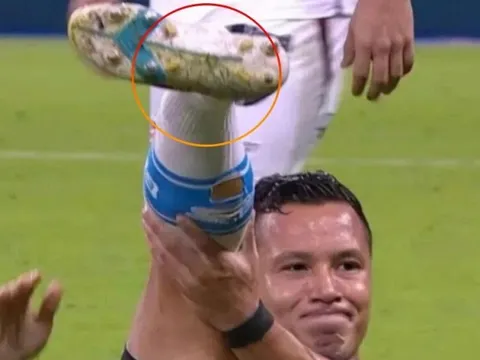 Cầu thủ Brazil bình thản dù cổ chân bị gãy