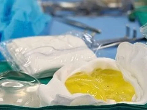 Vỡ túi ngực nhưng không hay biết