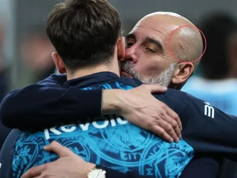 Pep Guardiola lại tự cào mặt