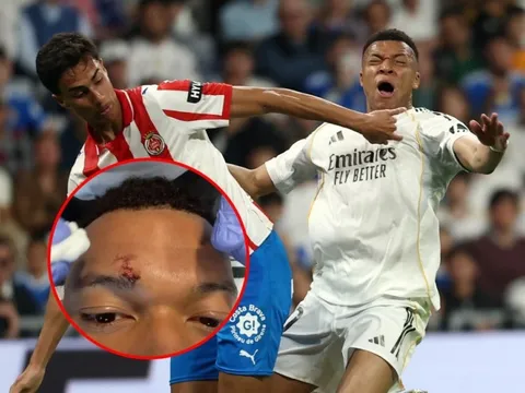 Mbappe gây lo lắng