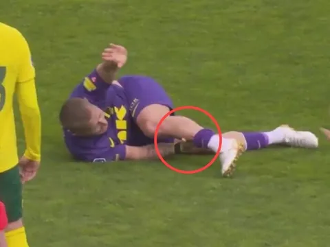 Cựu sao Tottenham dính chấn thương ghê rợn