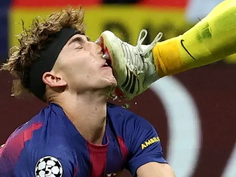 Cận cảnh tình huống Fermin Lopez dính trọn cú đạp vào mặt