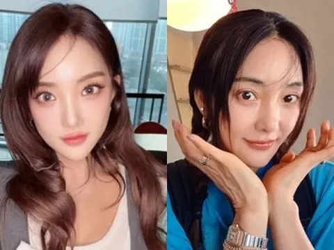 Nữ ca sĩ Bada (S.E.S) lên tiếng trước nghi vấn phẫu thuật thẩm mỹ