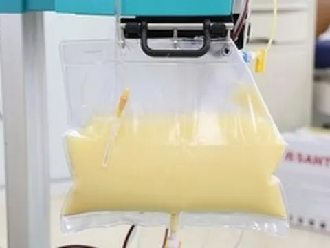 Mỡ máu cao gấp 20 lần, huyết tương đục như nước vo gạo