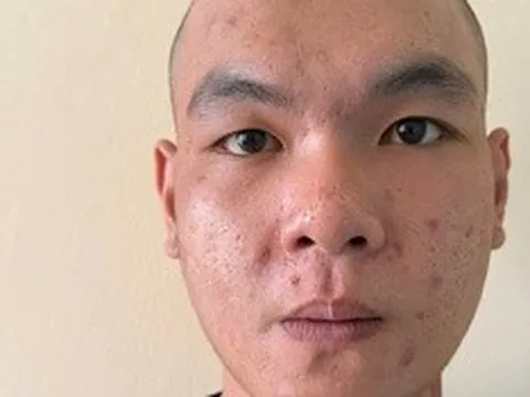 Cha ngủ say, con trai dắt trộm xe máy mang bán lấy tiền tiêu xài