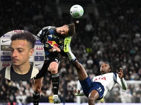 Sai lầm ngớ ngẩn của cầu thủ Tottenham