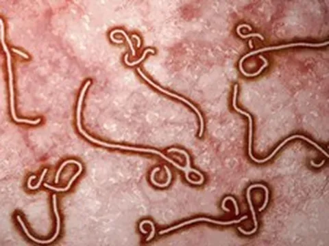WHO báo động khẩn về Ebola ở châu Phi, Việt Nam tăng giám sát cửa khẩu