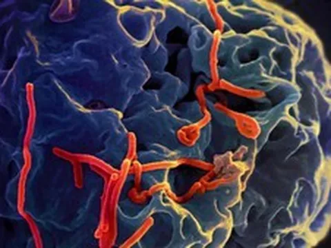 Bộ Y tế thông tin diễn biến phức tạp của dịch bệnh do virus Ebola