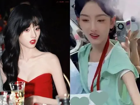Tình trạng đáng lo của Tống Tổ Nhi