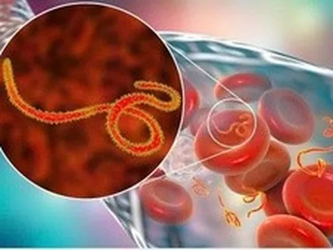 Dịch bệnh Ebola tiếp tục diễn biến phức tạp