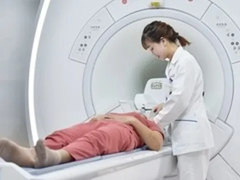 Người phụ nữ 44 tuổi đi khám đau đầu, bác sĩ bất ngờ khi nhìn kết quả chụp não
