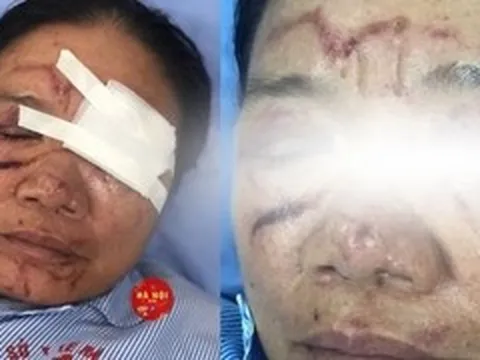Sức khỏe người phụ nữ bị xịt vòi nước cao áp ở Phú Thọ ra sao?