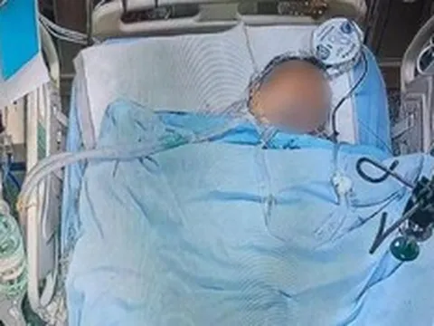 Đang cho gà ăn, người đàn ông bị con vật "đáng sợ" tấn công, diễn biến sau đó rùng mình