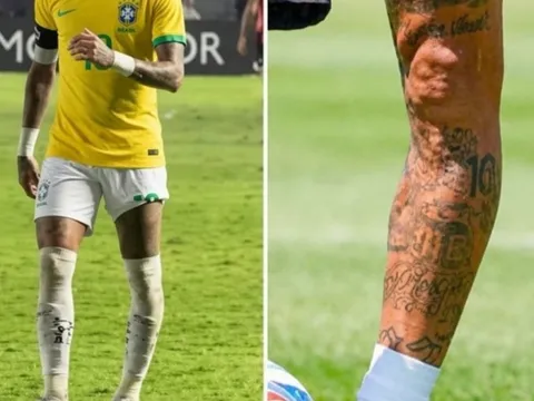 Ảnh chân trái biến dạng của Neymar hút hơn 7 triệu view
