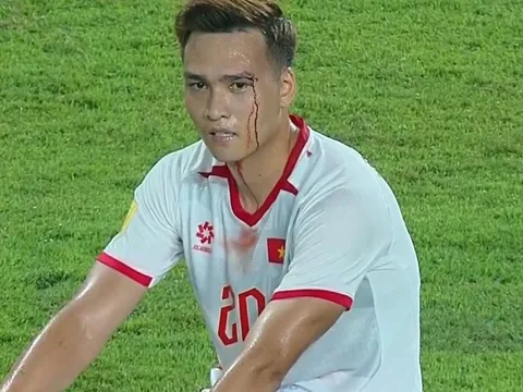 Trung vệ tuyển Việt Nam đổ máu