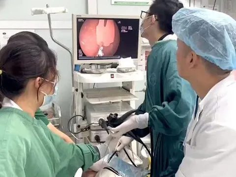 Bé trai 20 tháng tuổi nhập viện cấp cứu vì nuốt phải mảnh thìa nhựa