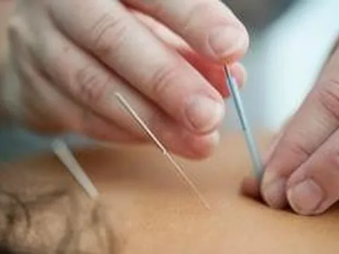 Đau chân dữ dội sau khi châm cứu, người phụ nữ sốc nặng khi biết sự thật đáng sợ
