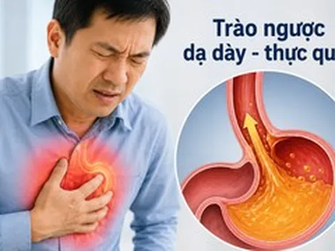 Đau ngực tưởng mắc bệnh tim, bác sĩ phát hiện 'thủ phạm' từ dạ dày