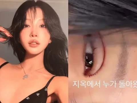 Sau 3 tháng kết hôn, Choi Joon Hee lộ đôi mắt sưng húp