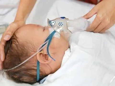 Virus RSV: Tác nhân phổ biến nhất gây viêm phổi ở trẻ nhỏ