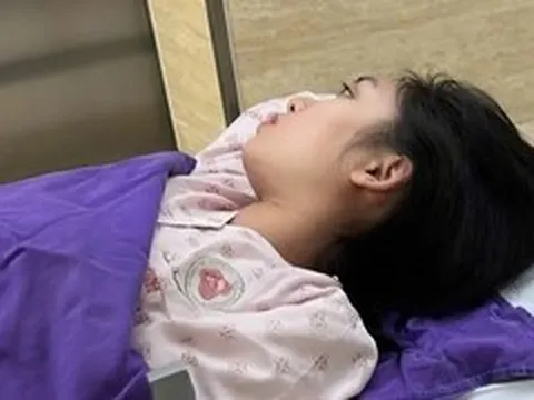 Cú sốc tuổi 30: Phát hiện phình mạch não từ cơn đau 'chịu một chút là qua'