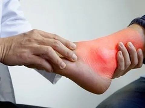 Chủ quan với đau khớp chân, thanh niên 20 tuổi ngỡ ngàng khi phát hiện mắc gout